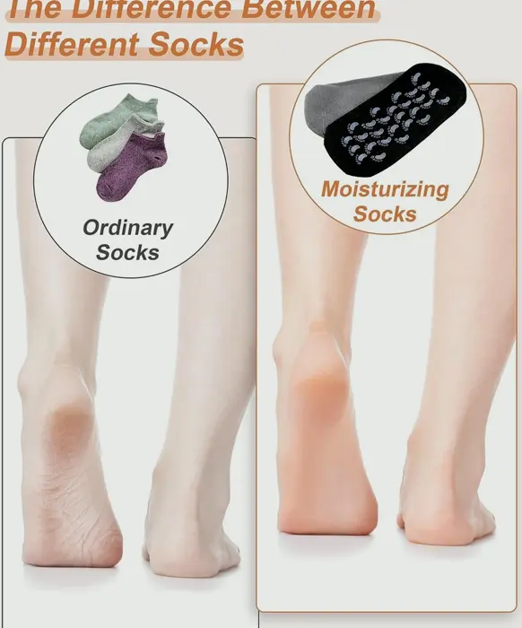 Hydrating Socks 2 Pairs for Cracked Feet