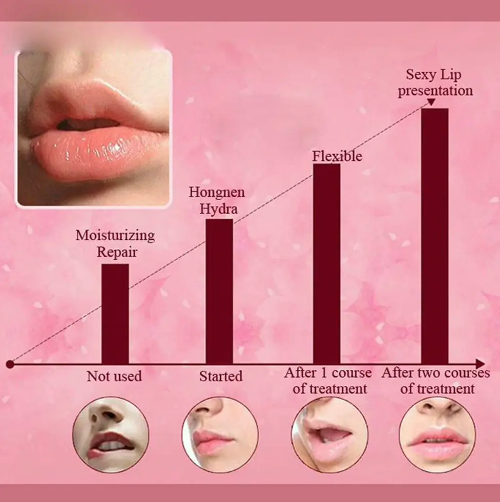 Mouth Mask Pack Rose Gel Sheets Treatment