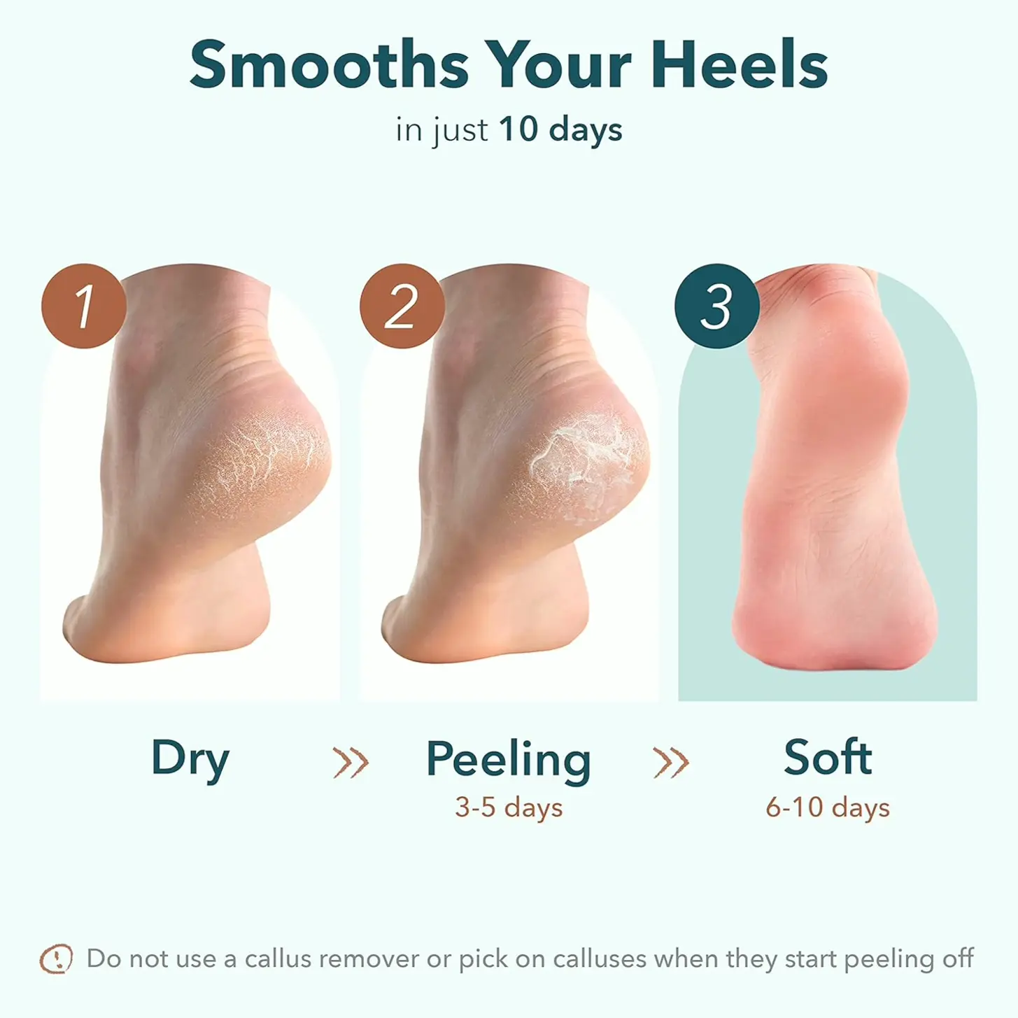 Exfoliating Heel Mask to Callus Care