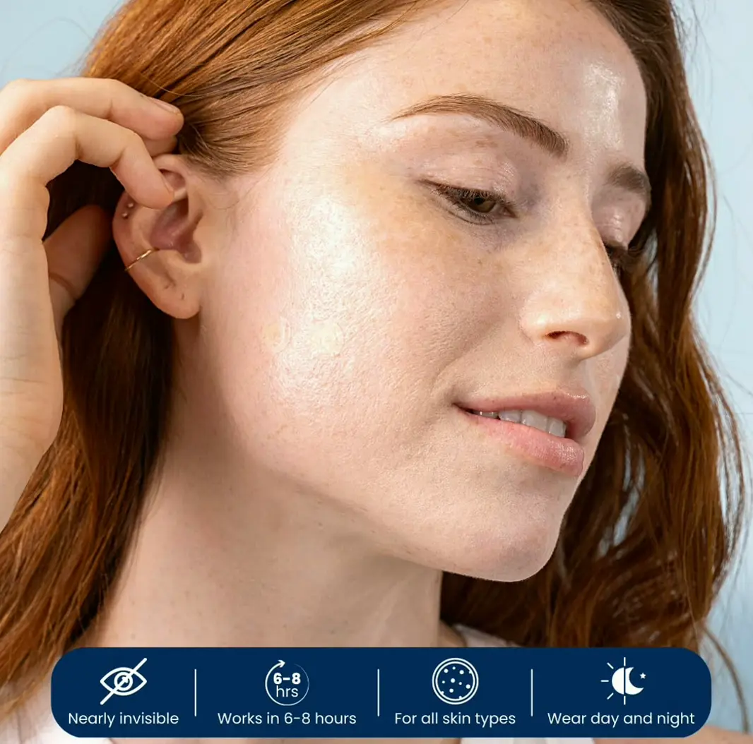 Vegan Pimple Patches - Zit Treatment Sticker