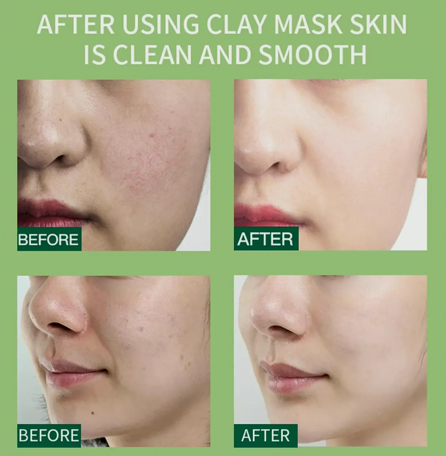 10 Pods Mud Facial Mask Kit