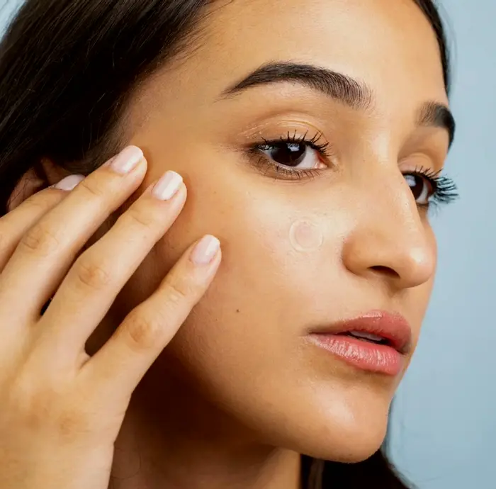 Vegan Pimple Patches - Zit Treatment Sticker